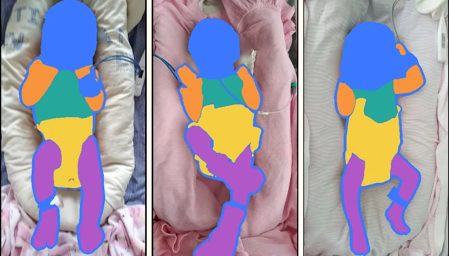 Three newborns with body parts segmented as opaque masks: head, trunk, diaper, arms and legs.
